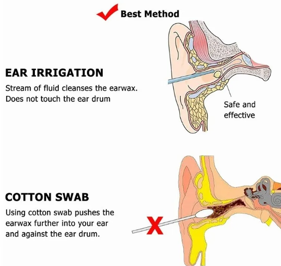 Set Limpiador Oído Acero Inoxidable 6Pza
